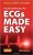 ECGs Made Easy 5th Edition By Aehlert RN BSPA – Test Bank